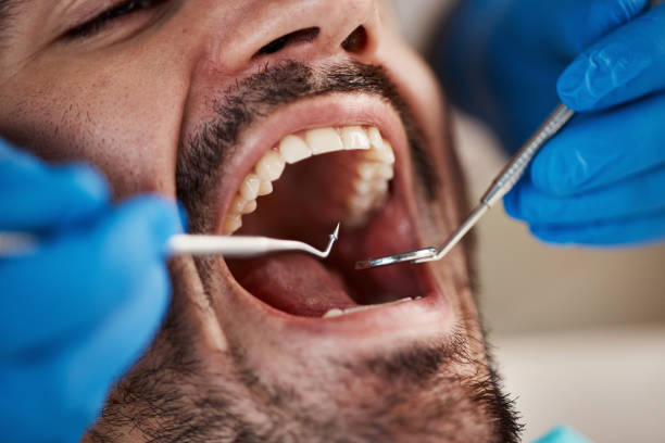 Best Chipped Tooth Repair Near Me  in Berkshire Lakes, FL